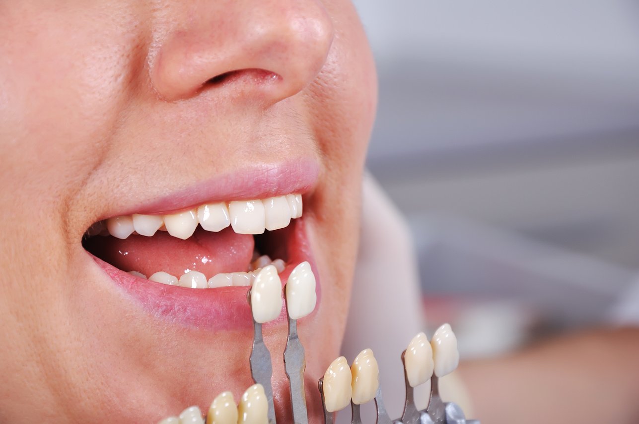 Dentist Matching the Shade of Teeth